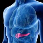 Cystic Lesions of Pancreas