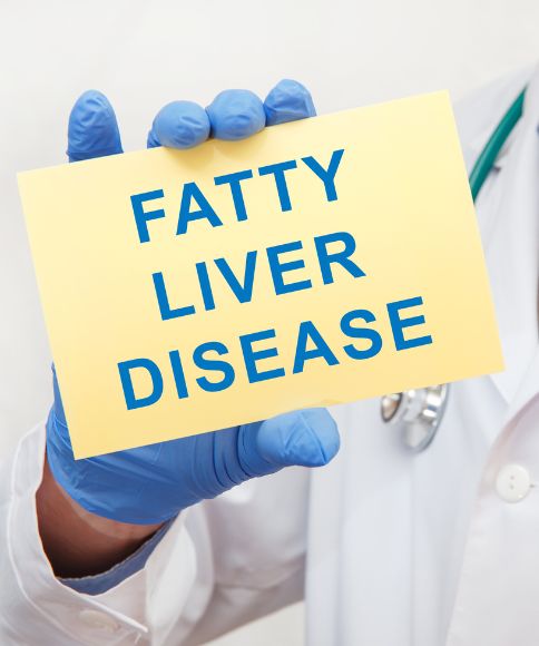 Fatty Liver Disease